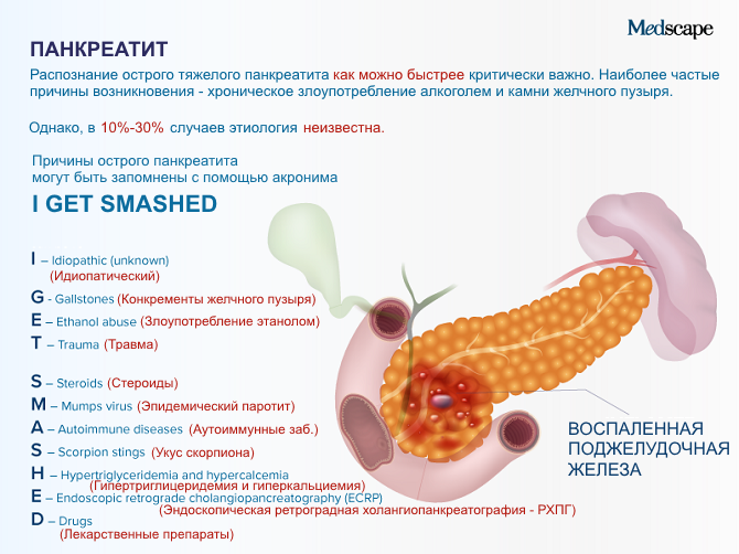 Острый панкреатит карта