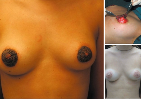 Odessada sutenyorlarsiz arzon fohishalar