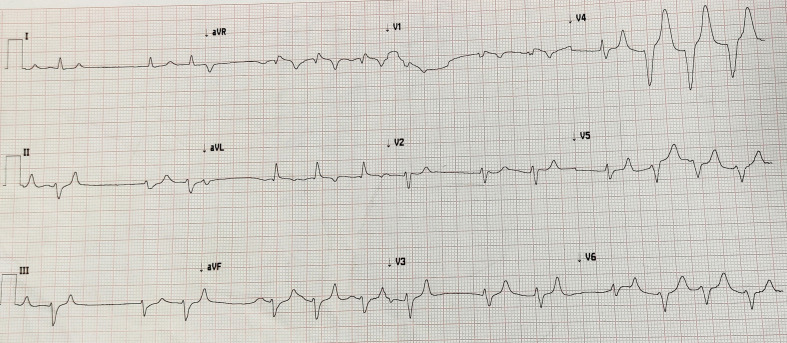     QRS - 